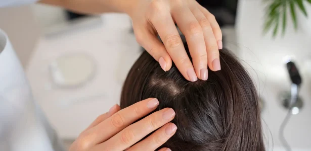 Ayurvedic Dietary tips for better Hair health.